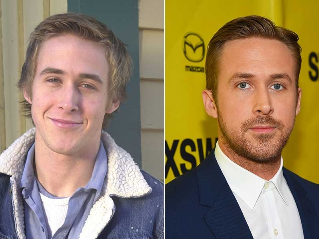Why more men are opting for plastic surgery