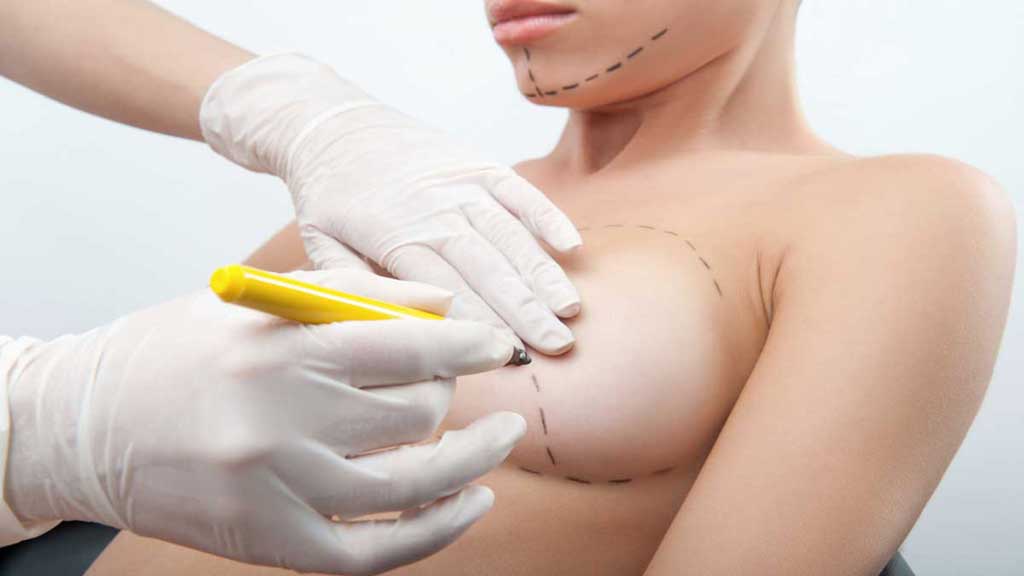 Breast Fat Transfer – A Way To Avoid Implant-Related Cancer Or A More Risky Procedure?